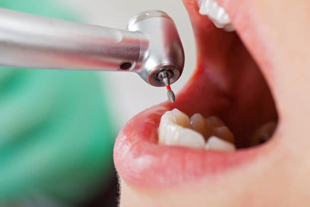 Best Cracked Tooth Emergency Dentist  in Montgomery, MN